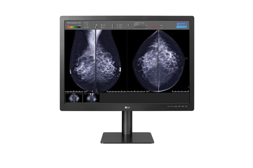 Monitor médico de mamografia 2.